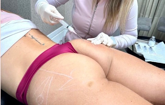 Preenchimento Águas Claras - 6