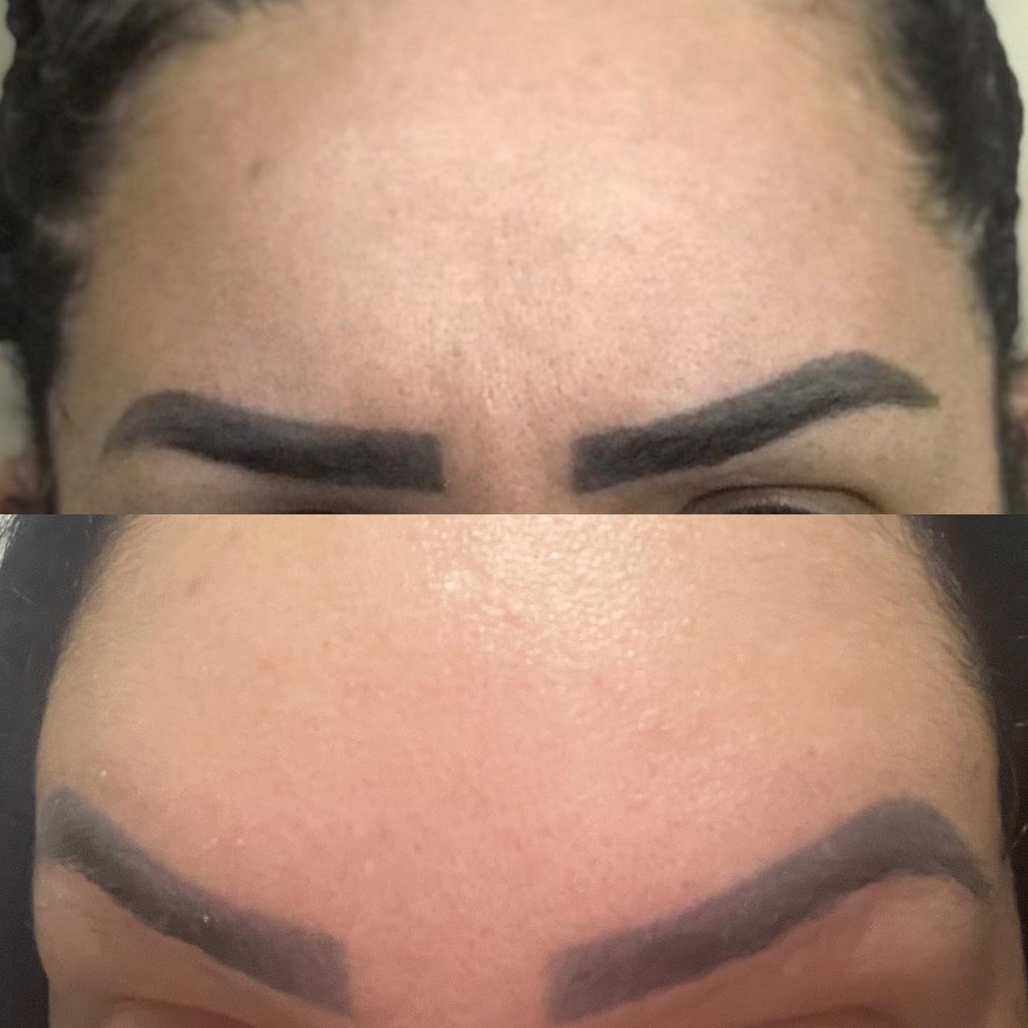 Toxina Btx Águas Claras - 12