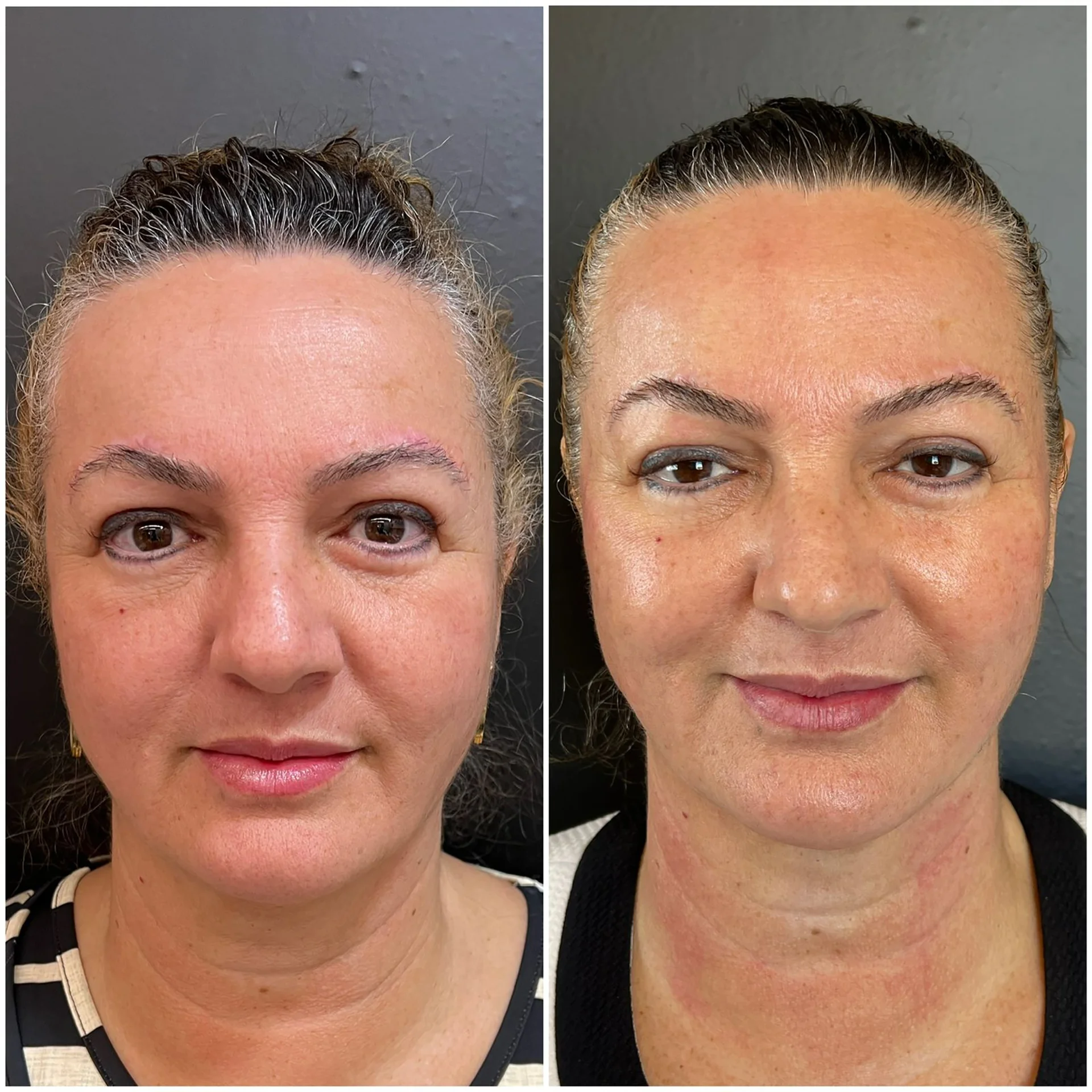 Bioestimulador Natural Alta Tecnologia Hipro 13