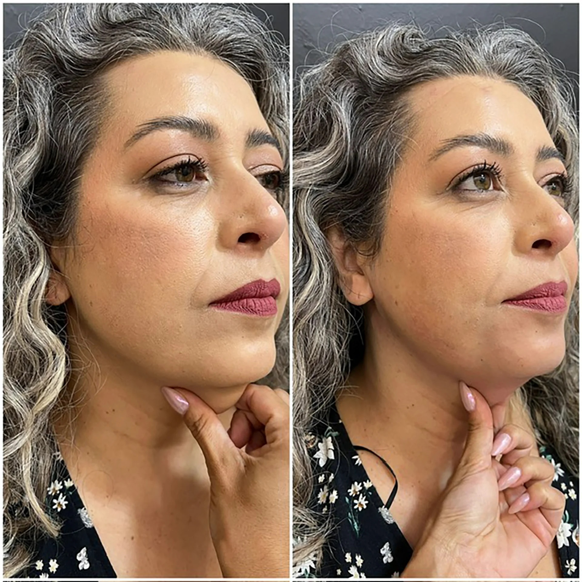 Bioestimulador Natural Alta Tecnologia Hipro 14