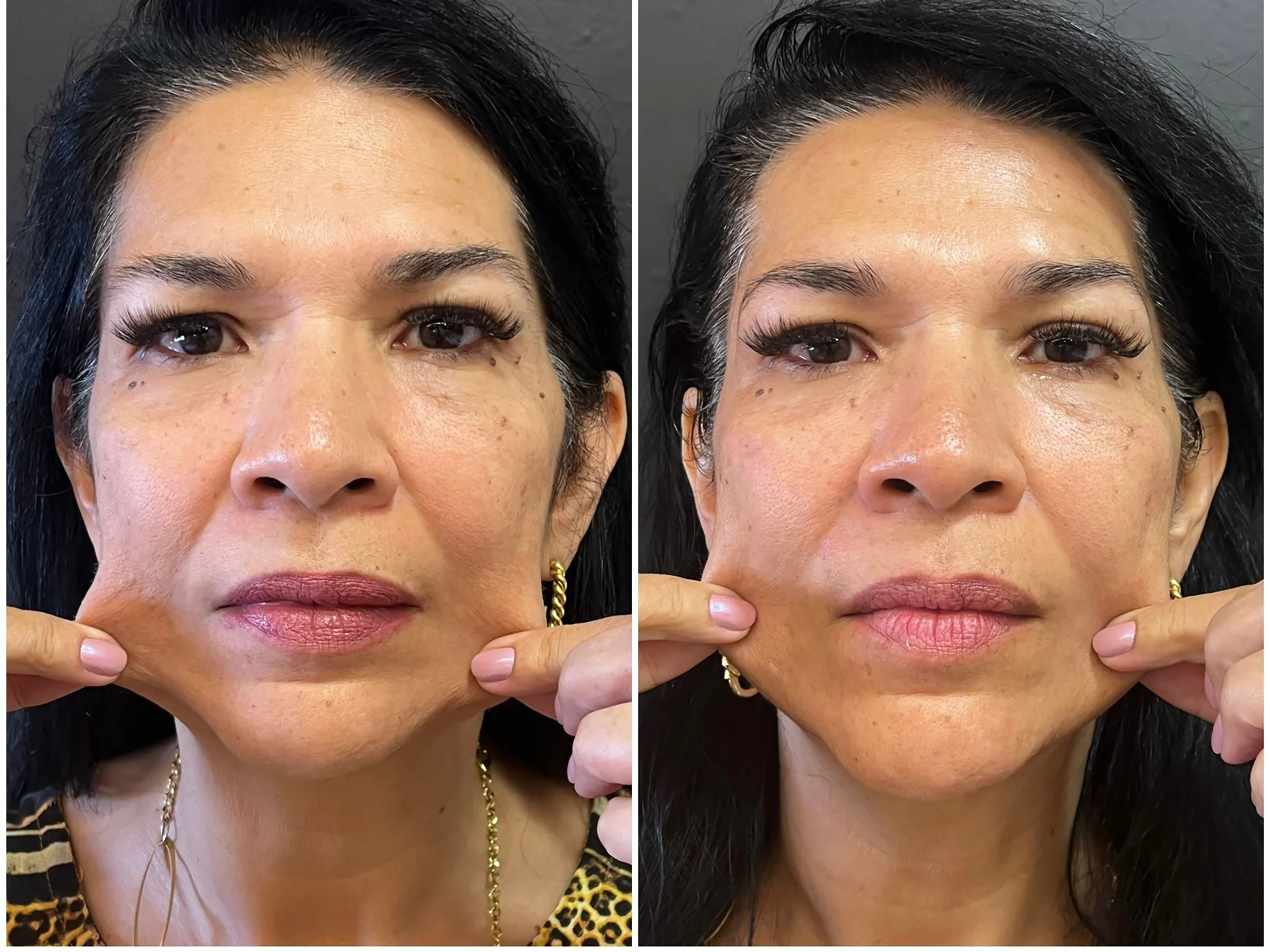 Bioestimulador Natural Alta Tecnologia Hipro 15