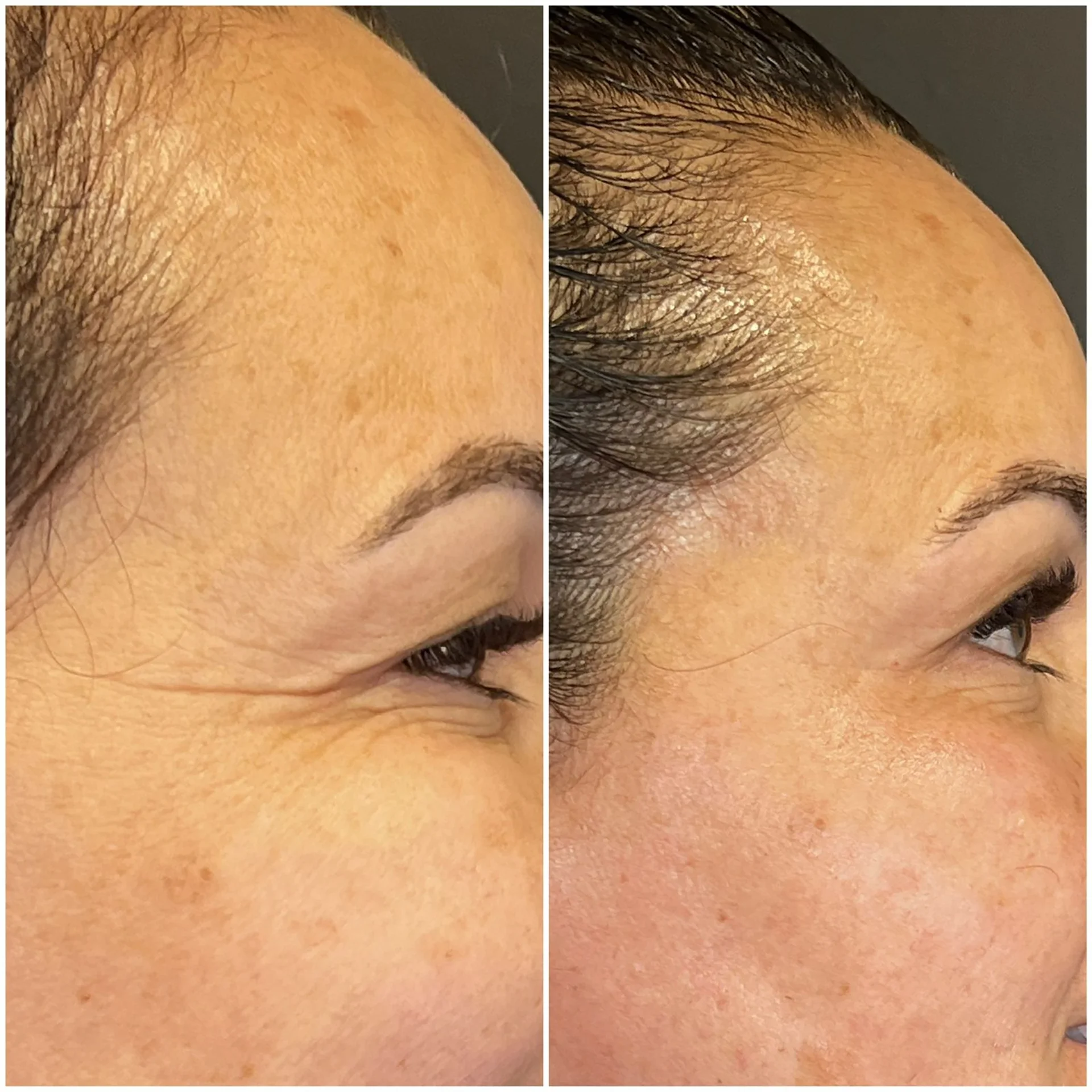 Bioestimulador Natural Alta Tecnologia Hipro 16