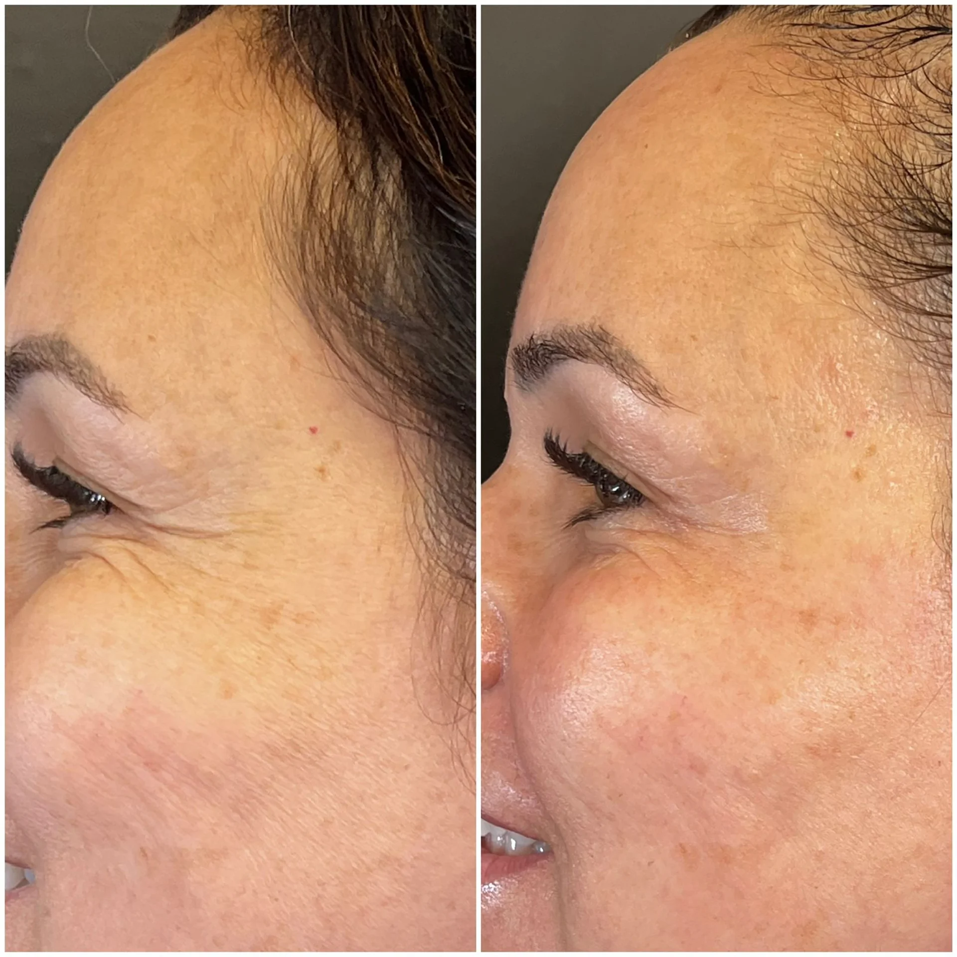 Bioestimulador Natural Alta Tecnologia Hipro 17