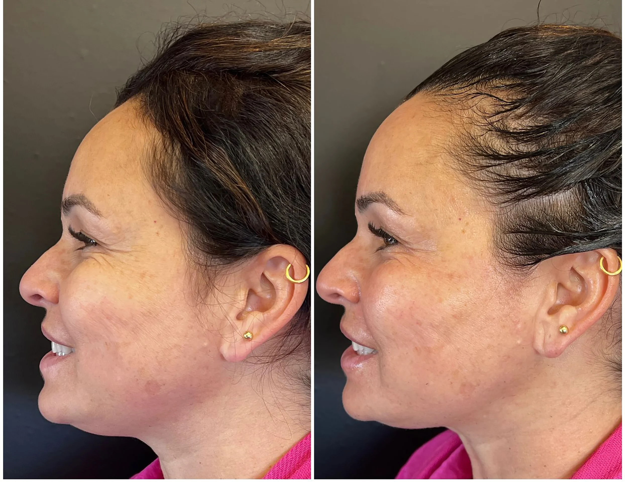 Bioestimulador Natural Alta Tecnologia Hipro 18