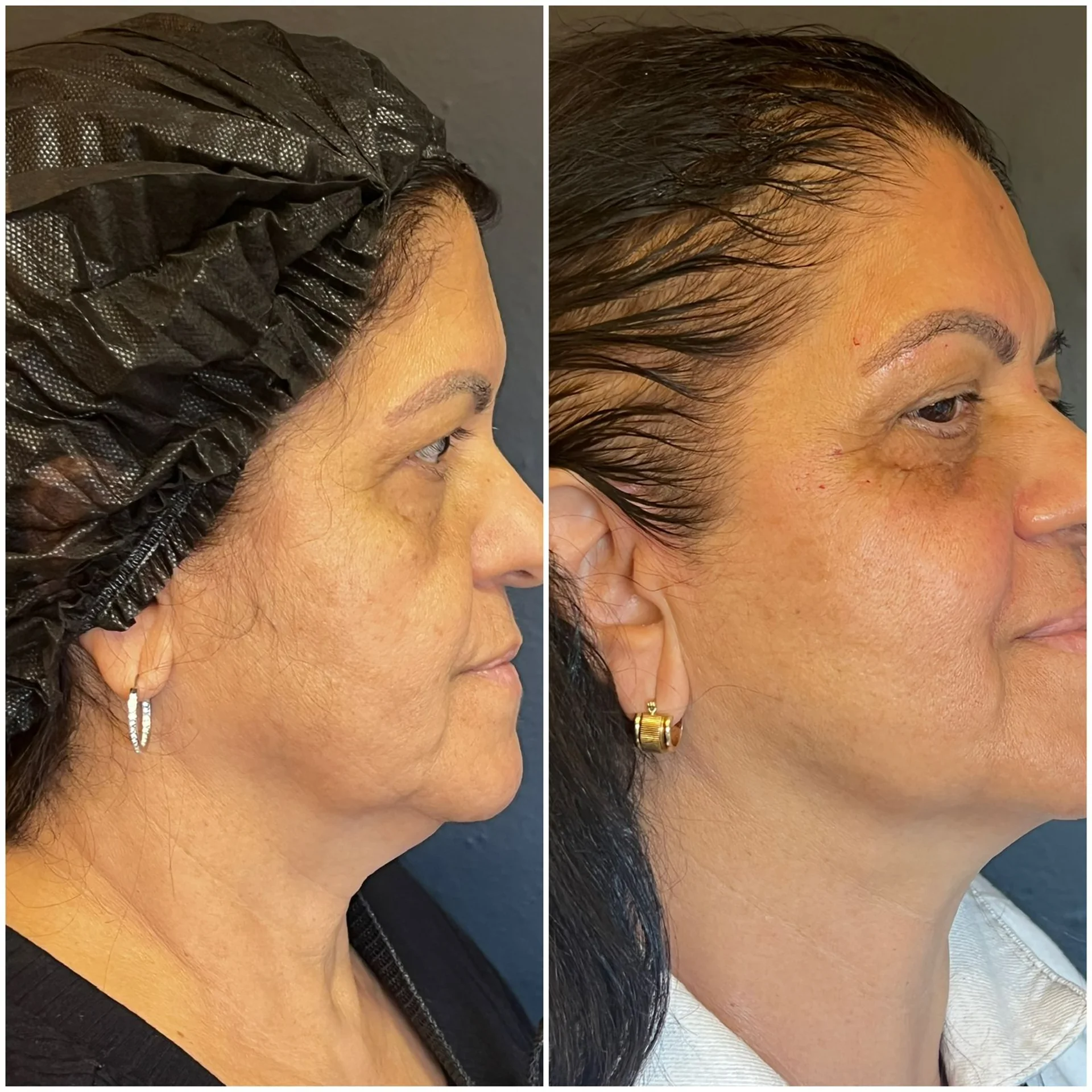 Bioestimulador Natural Alta Tecnologia Hipro 19