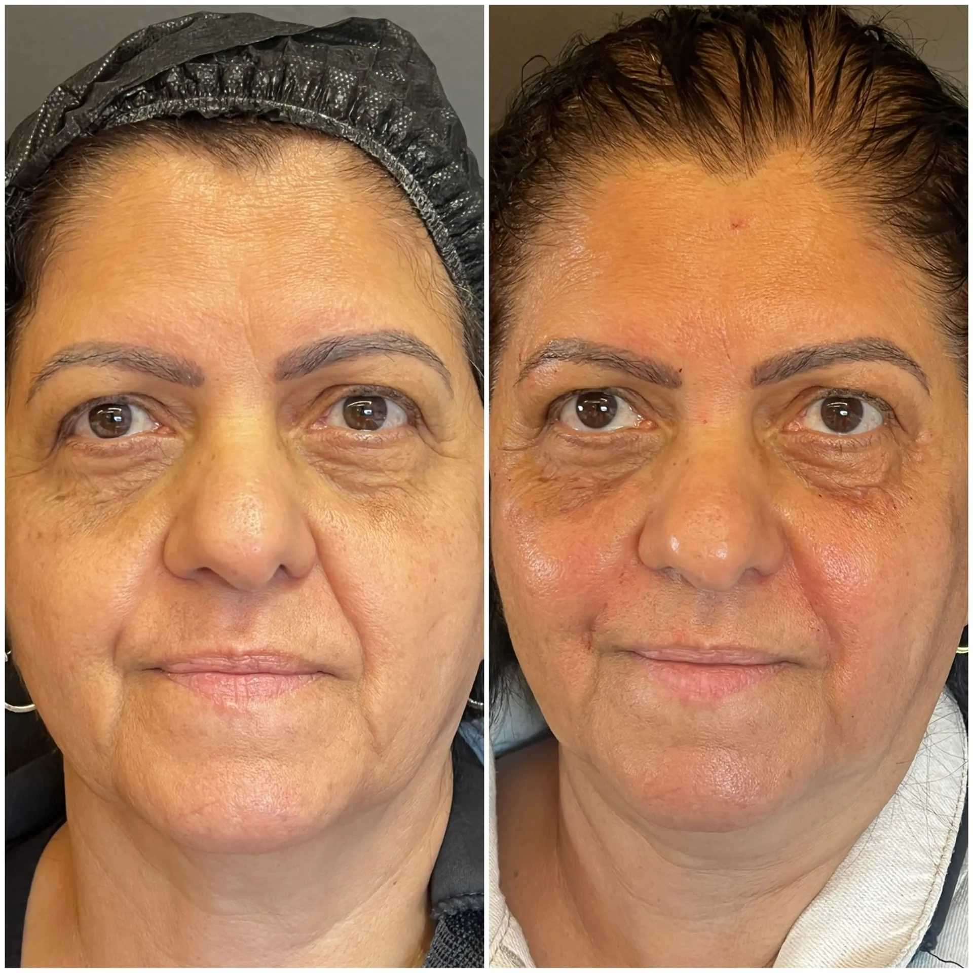 Bioestimulador Natural Alta Tecnologia Hipro 20