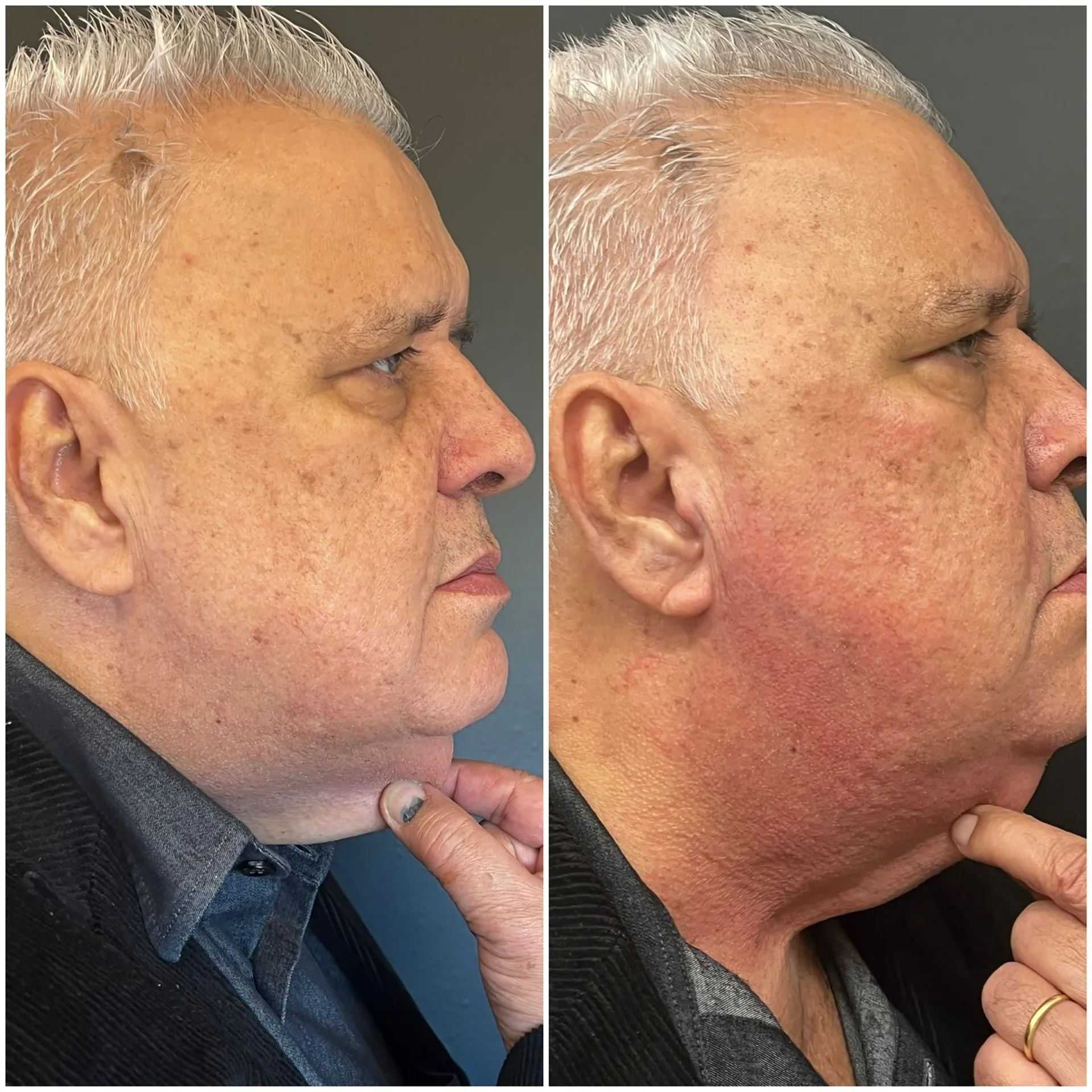 Bioestimulador Natural Alta Tecnologia Hipro 21