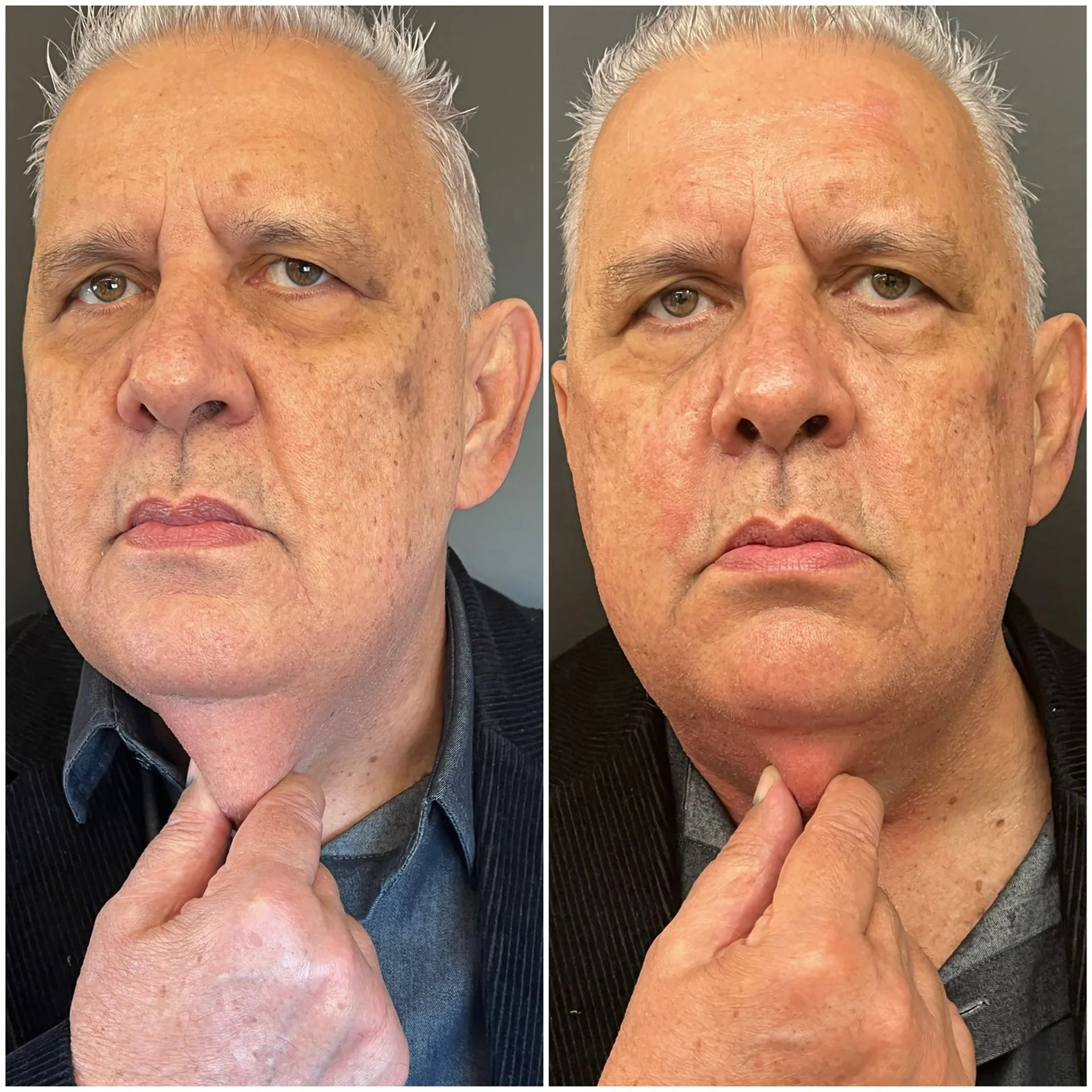 Bioestimulador Natural Alta Tecnologia Hipro 22