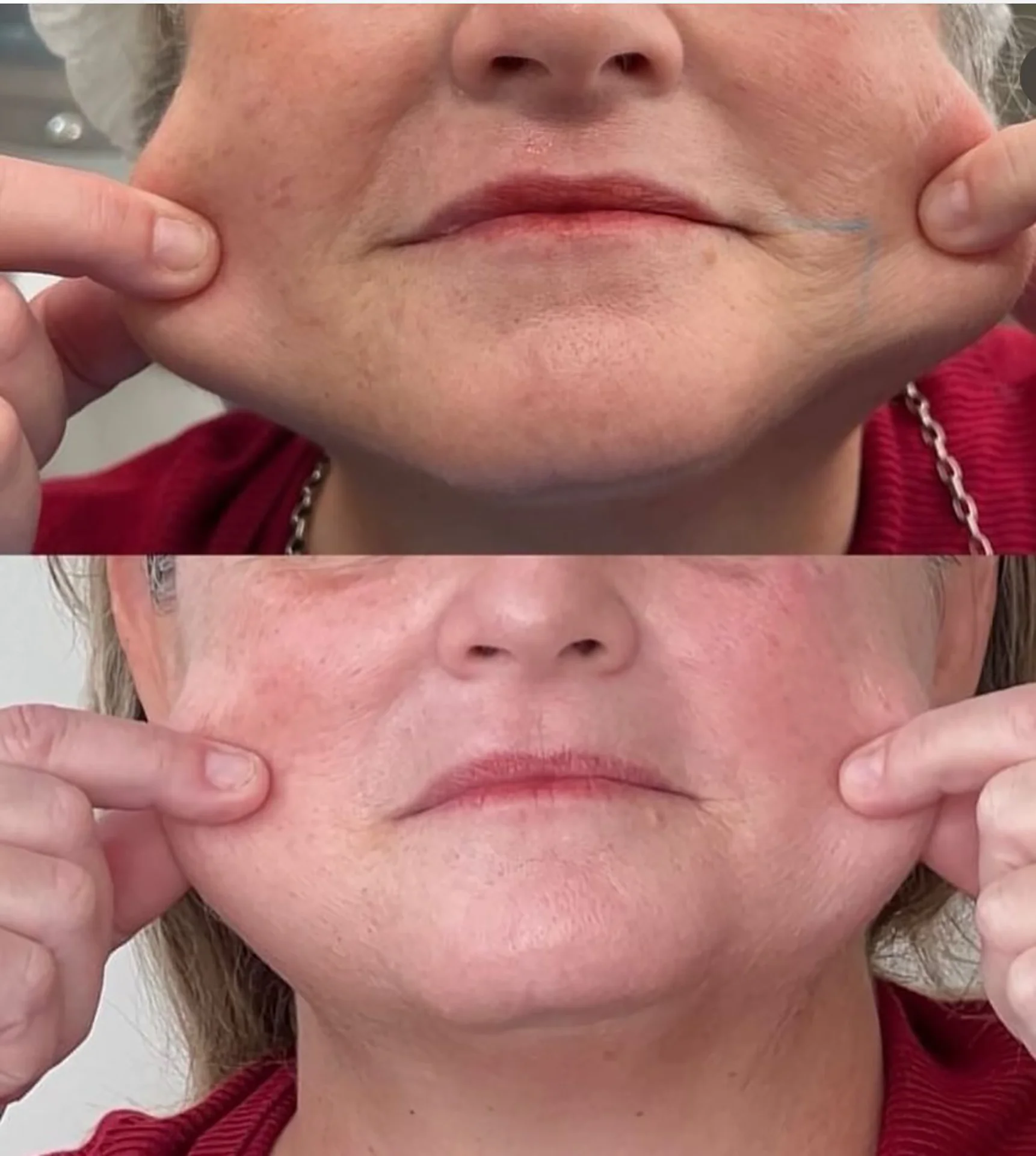 Bioestimulador Natural Alta Tecnologia Hipro 23