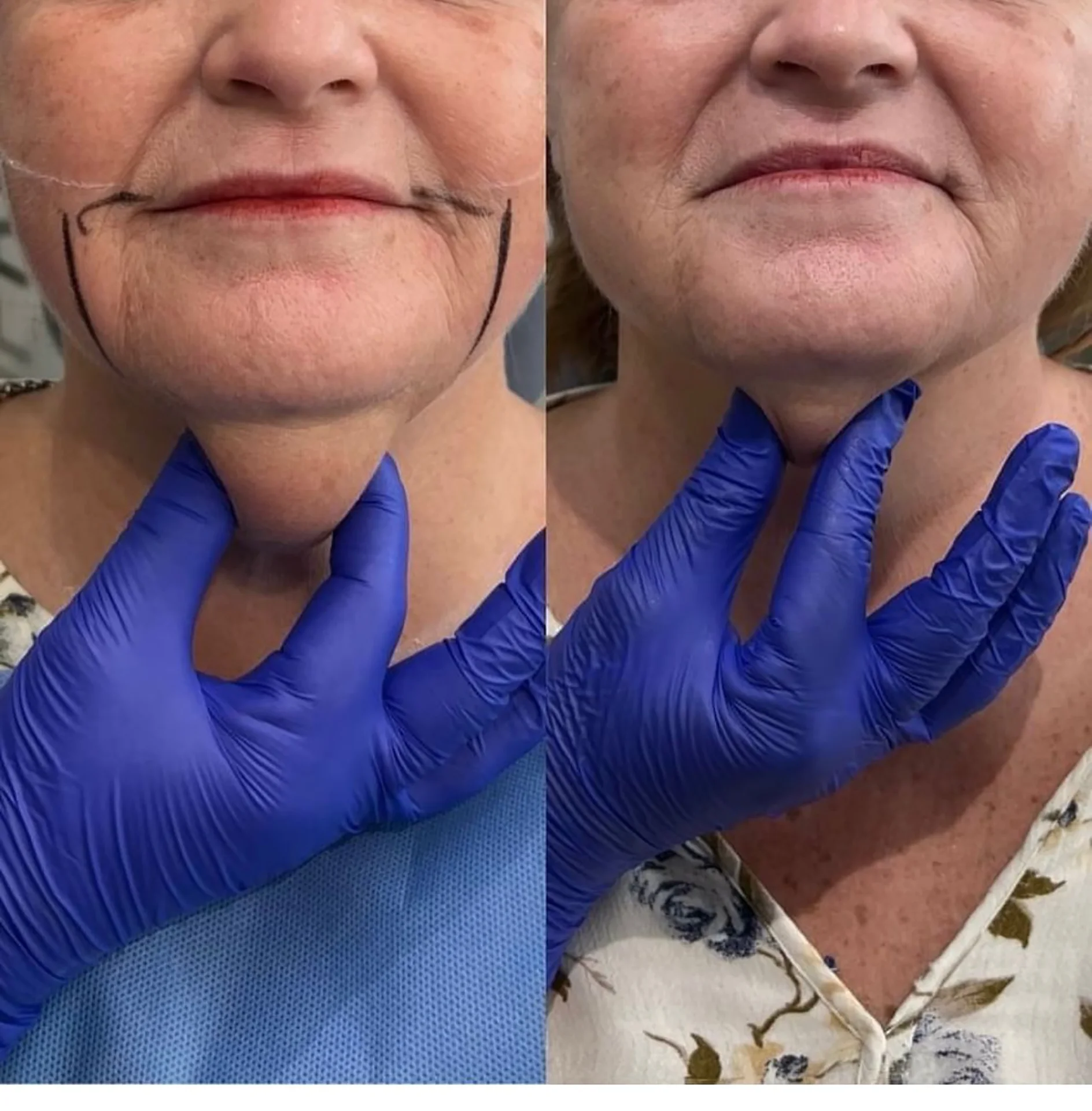 Bioestimulador Natural Alta Tecnologia Hipro 24