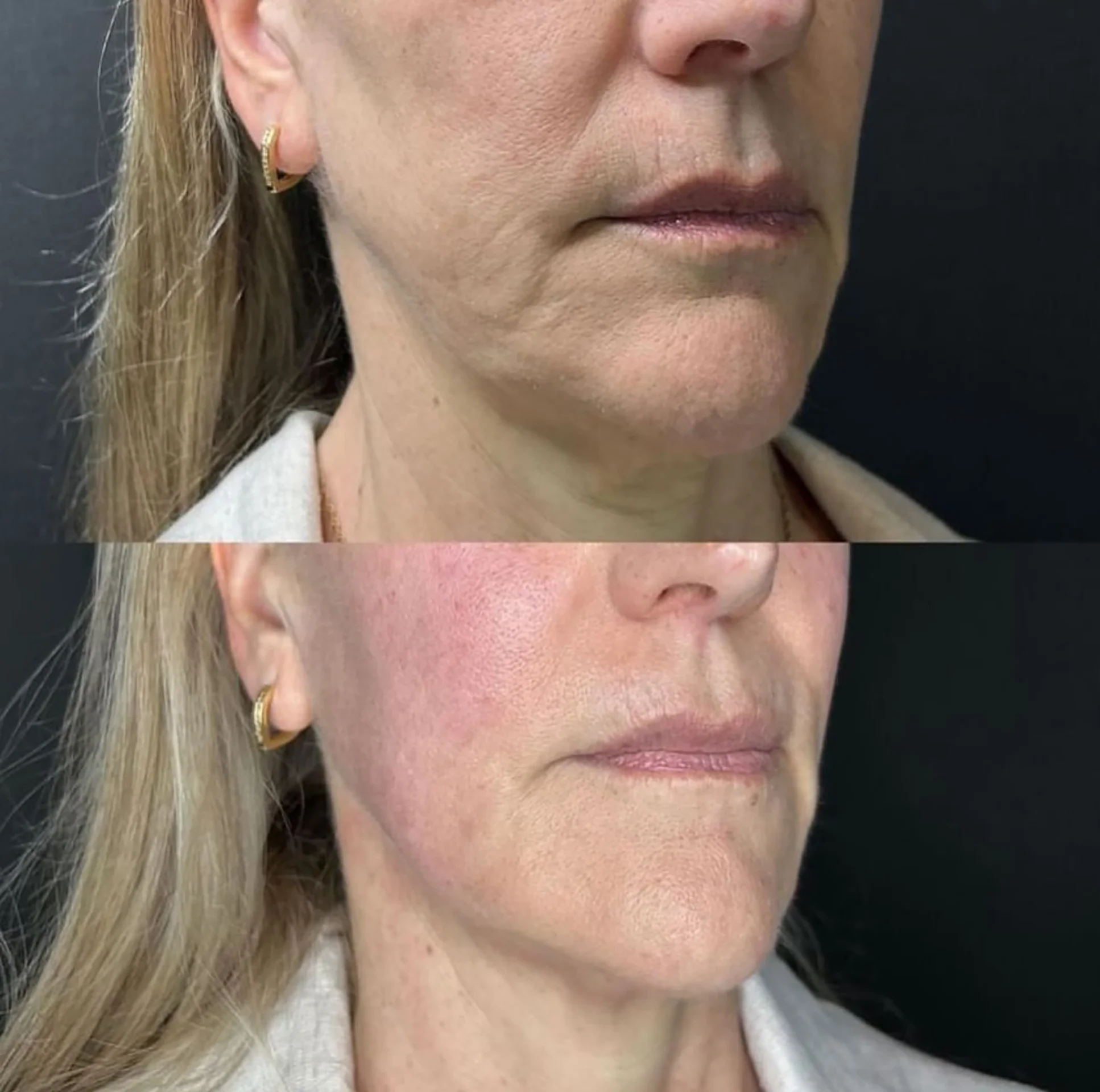 Bioestimulador Natural Alta Tecnologia Hipro 25