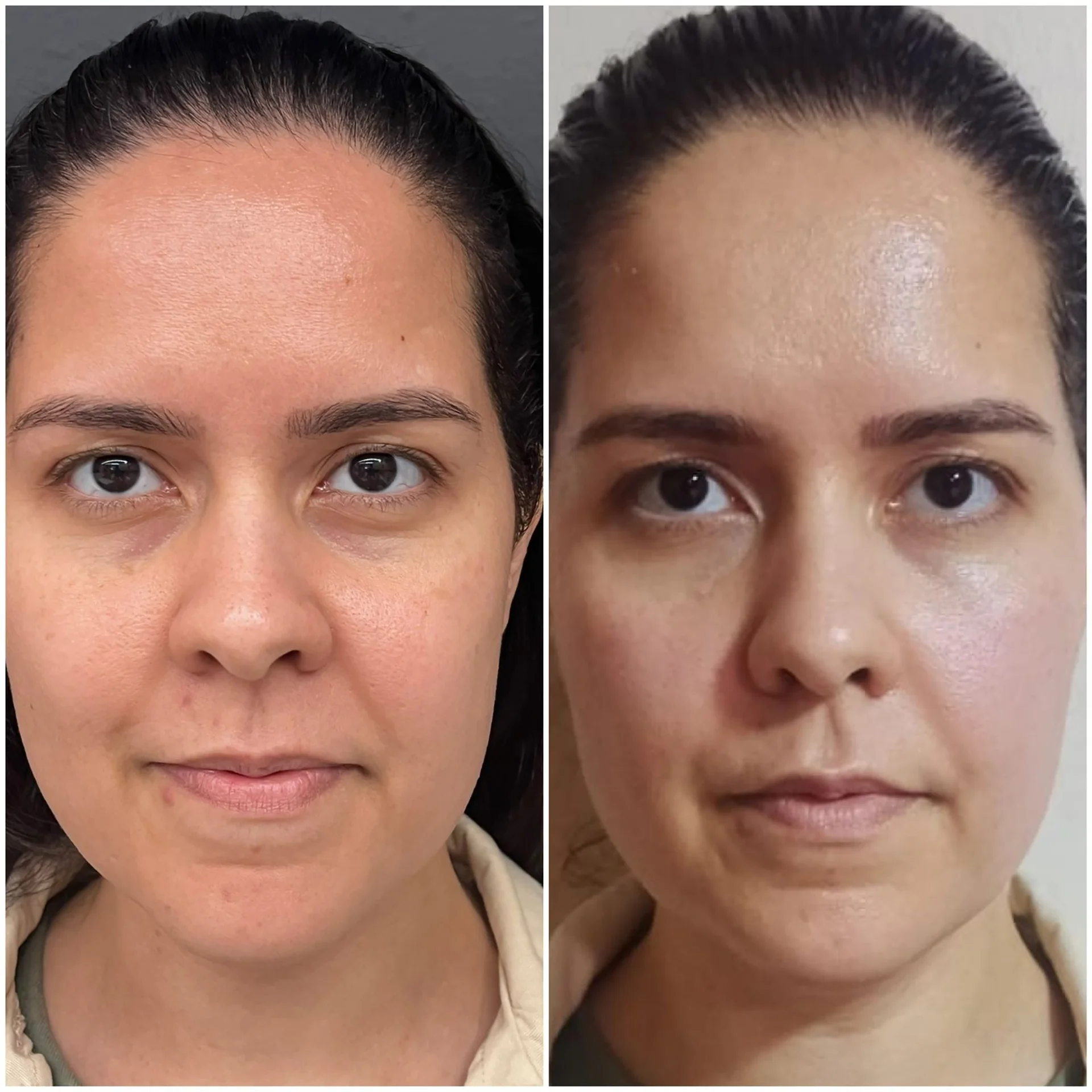 Bioestimulador Natural Alta Tecnologia Hipro 29