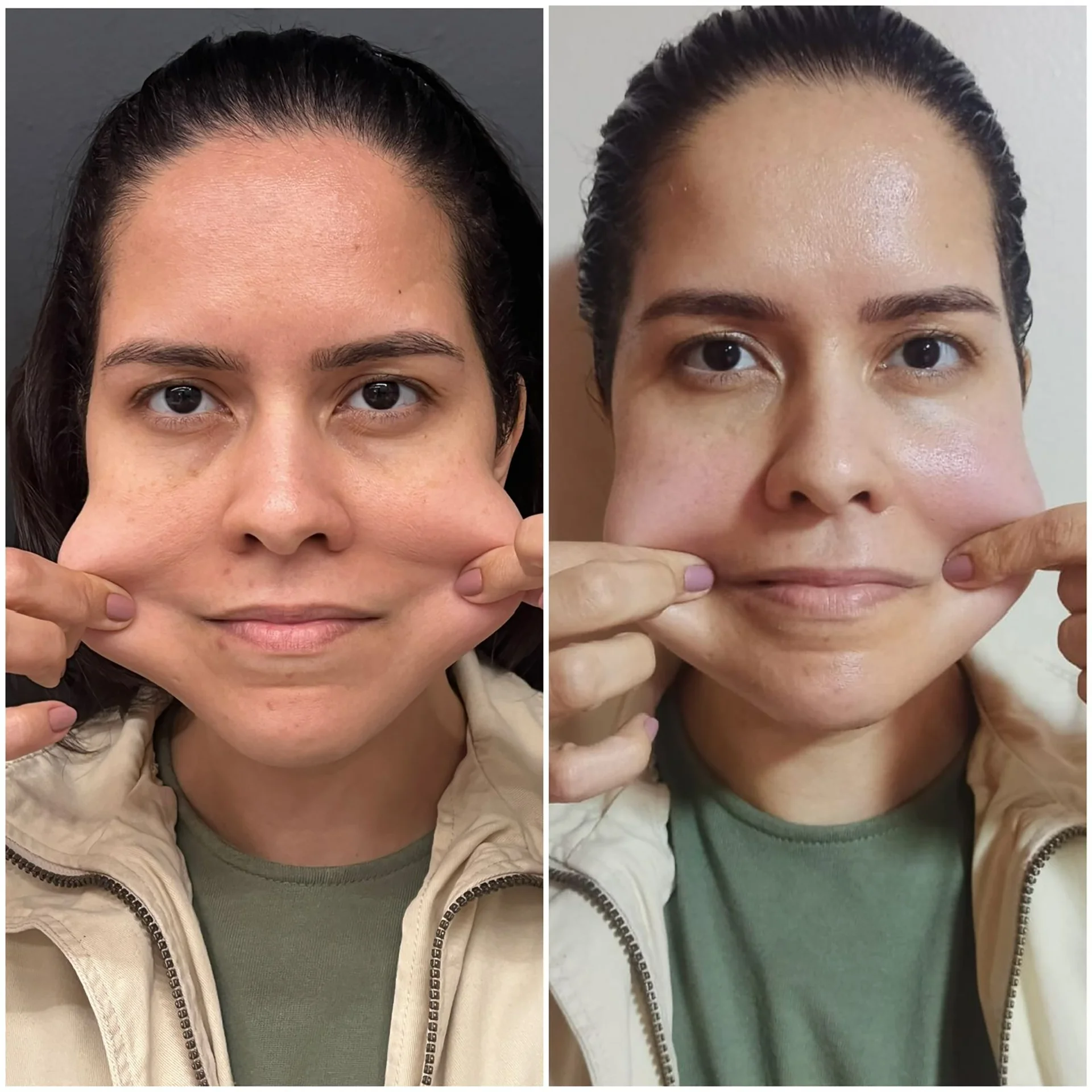 Bioestimulador Natural Alta Tecnologia Hipro 30