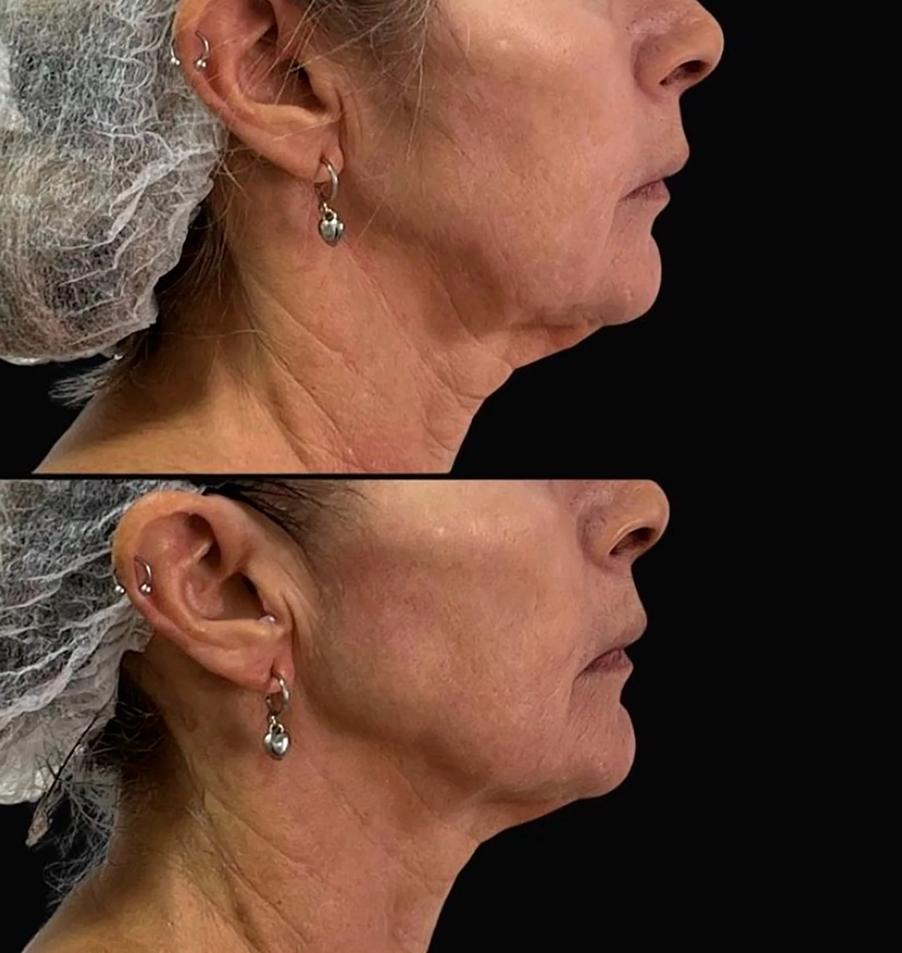 Bioestimulador Natural Alta Tecnologia Hipro 31