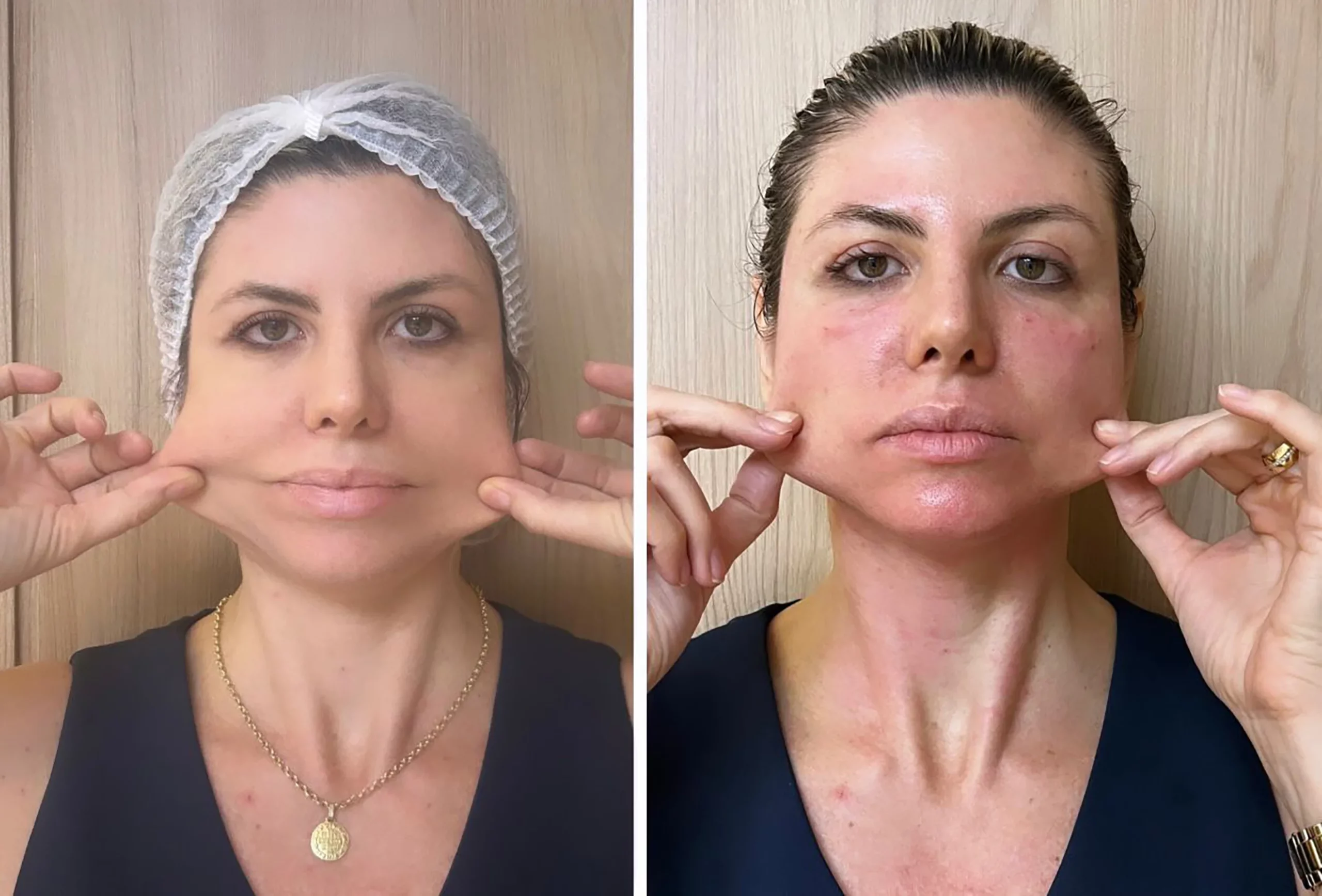 Bioestimulador Natural Alta Tecnologia Hipro 32