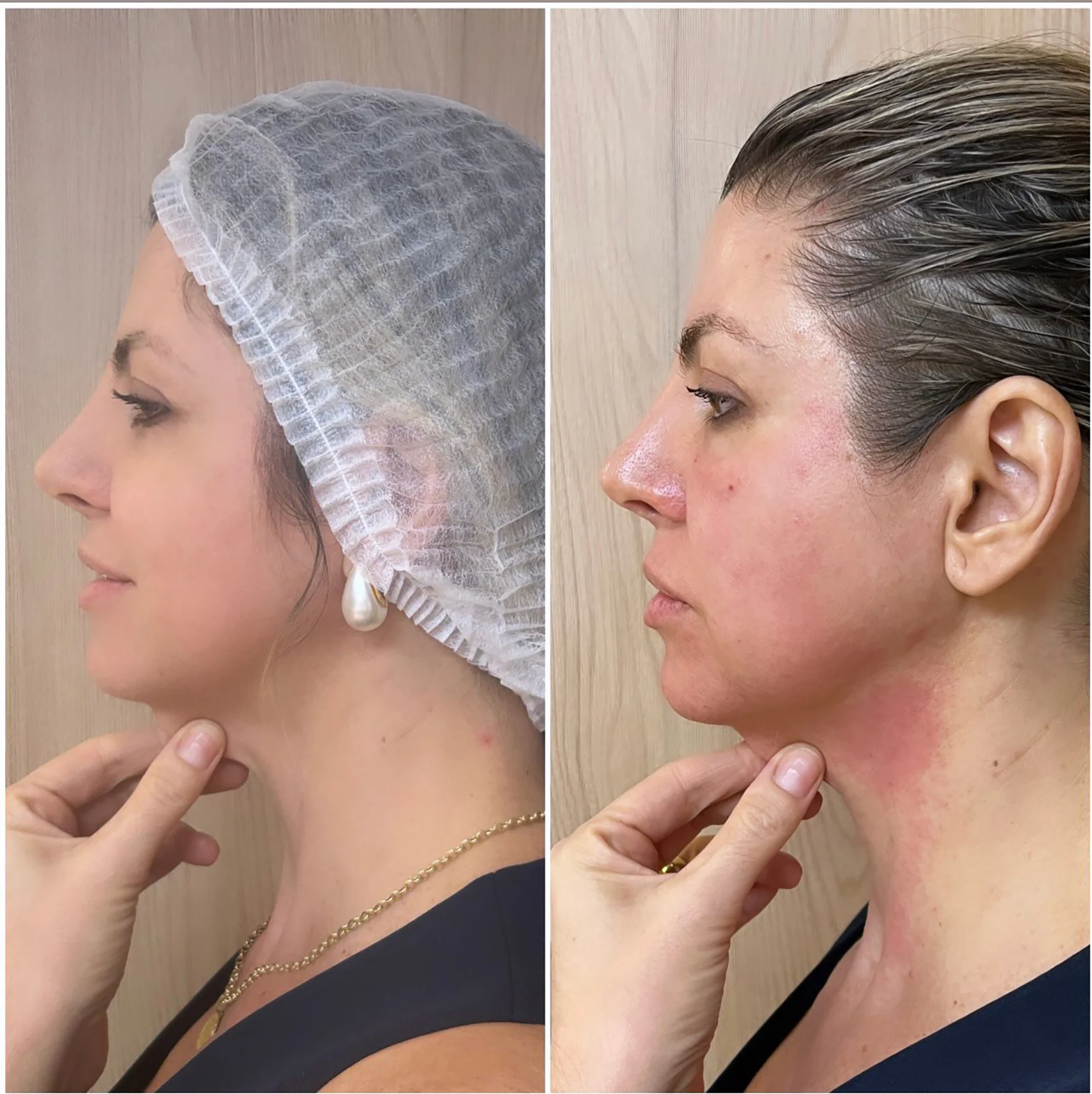 Bioestimulador Natural Alta Tecnologia Hipro 33