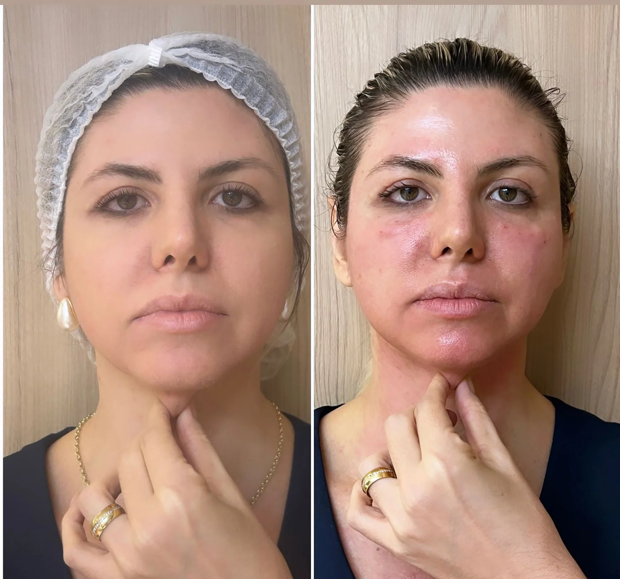 Bioestimulador Natural Alta Tecnologia Hipro 34