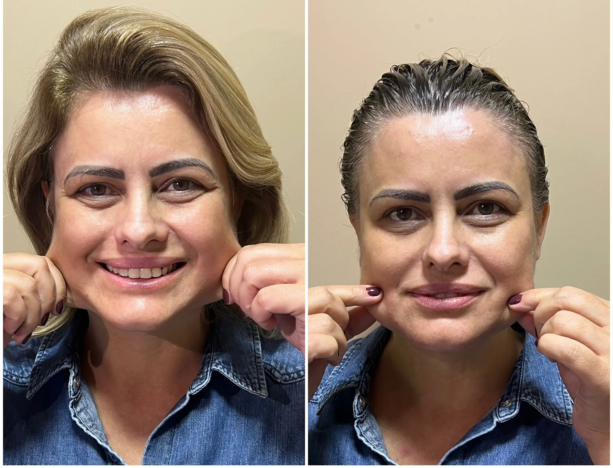 Bioestimulador Natural Alta Tecnologia Hipro 35