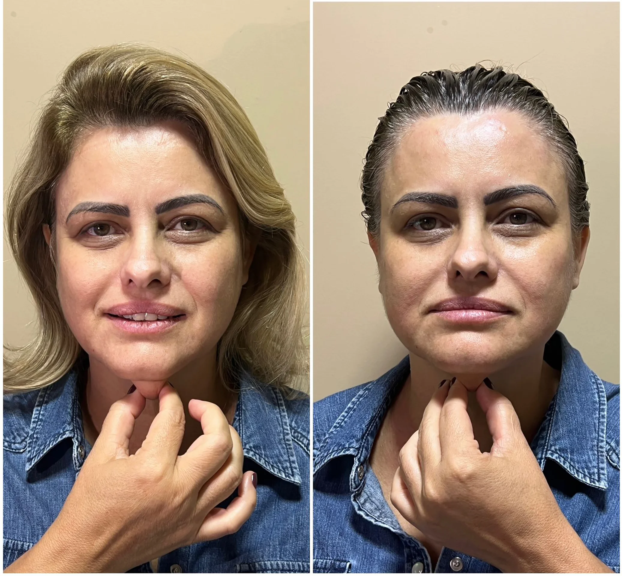 Bioestimulador Natural Alta Tecnologia Hipro 36