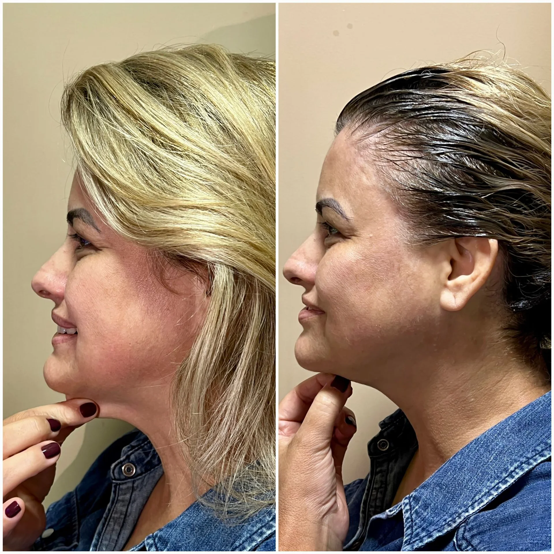 Bioestimulador Natural Alta Tecnologia Hipro 37