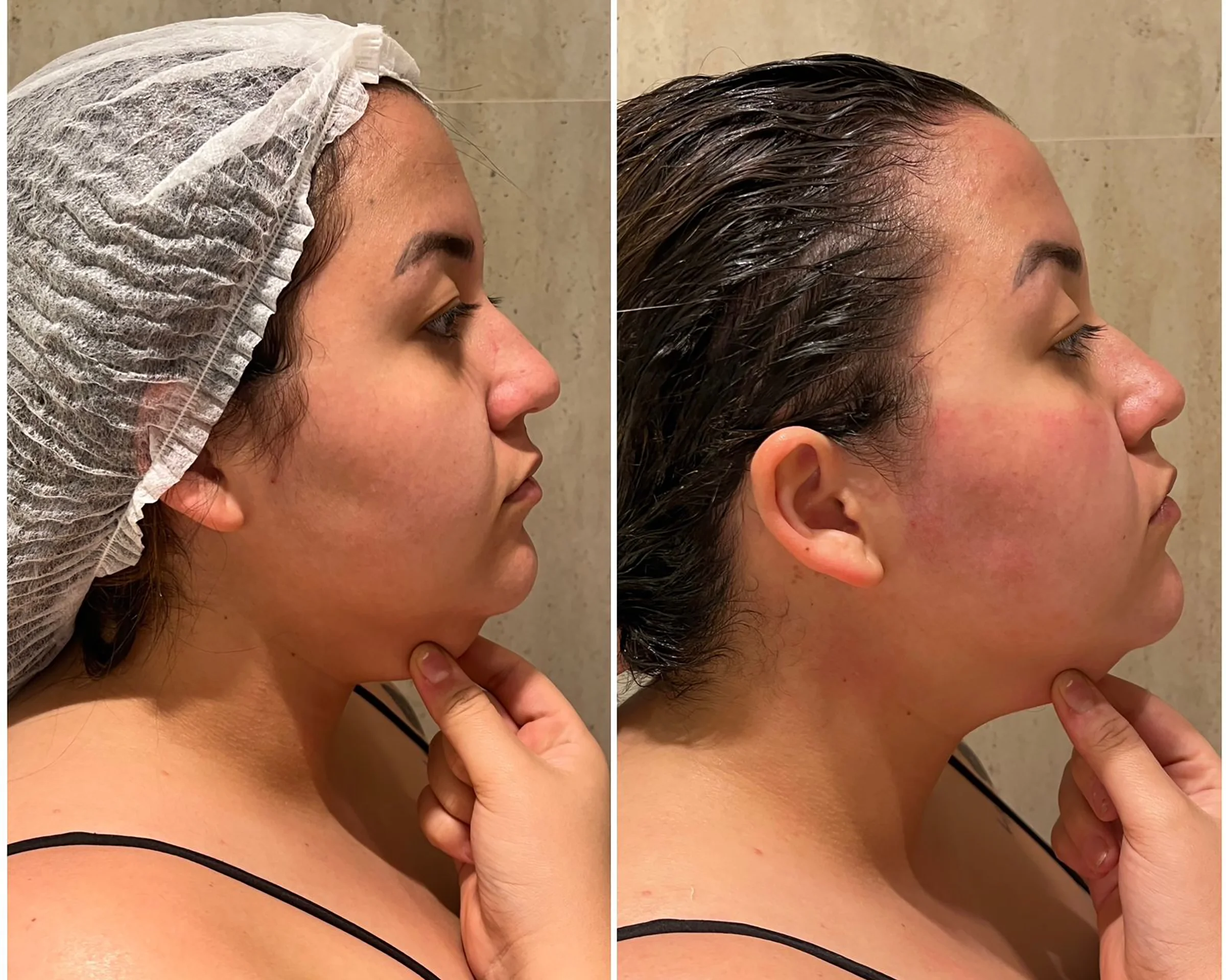 Bioestimulador Natural Alta Tecnologia Hipro 38