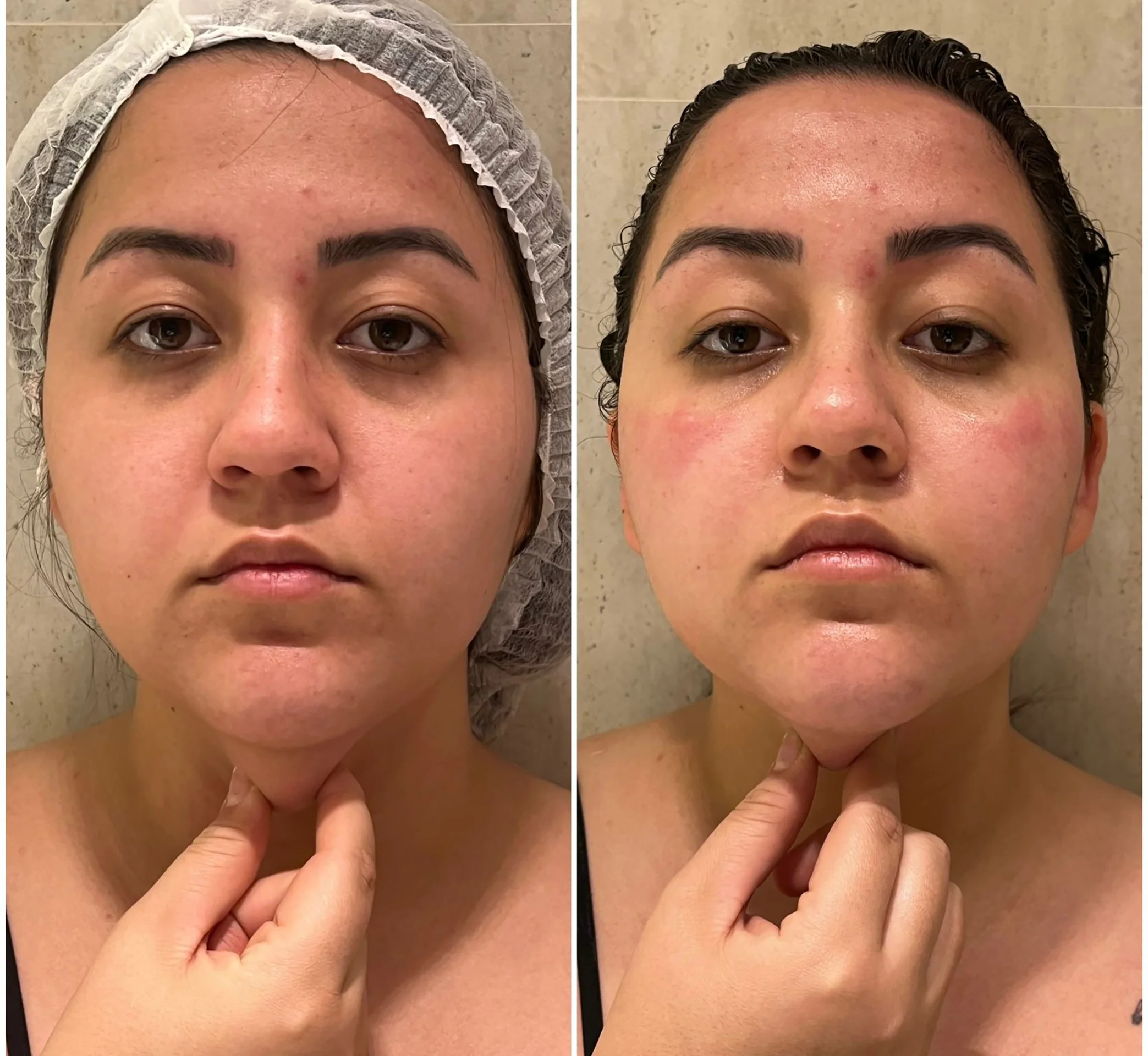 Bioestimulador Natural Alta Tecnologia Hipro 39