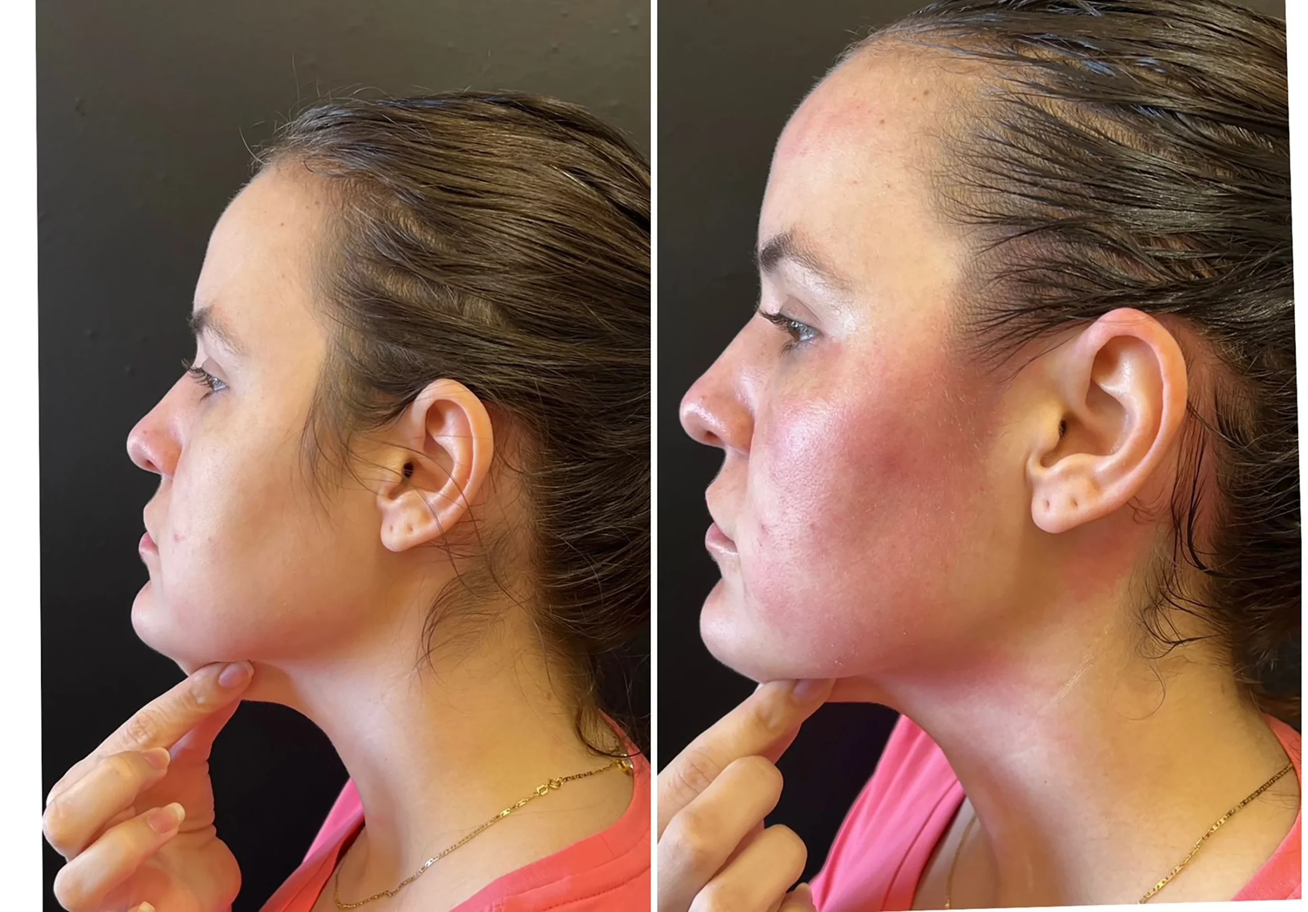 Bioestimulador Natural Alta Tecnologia Hipro 40