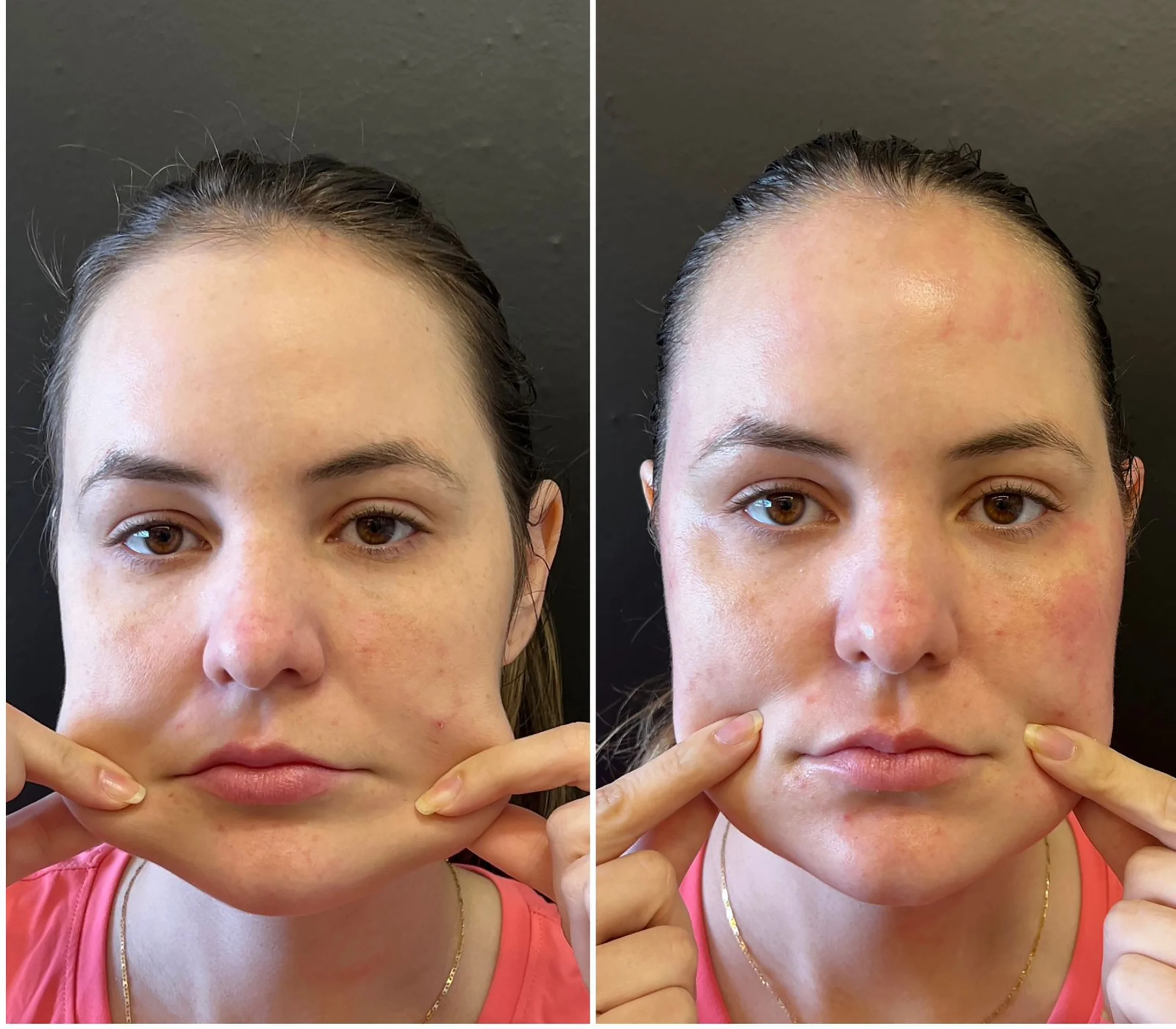 Bioestimulador Natural Alta Tecnologia Hipro 41